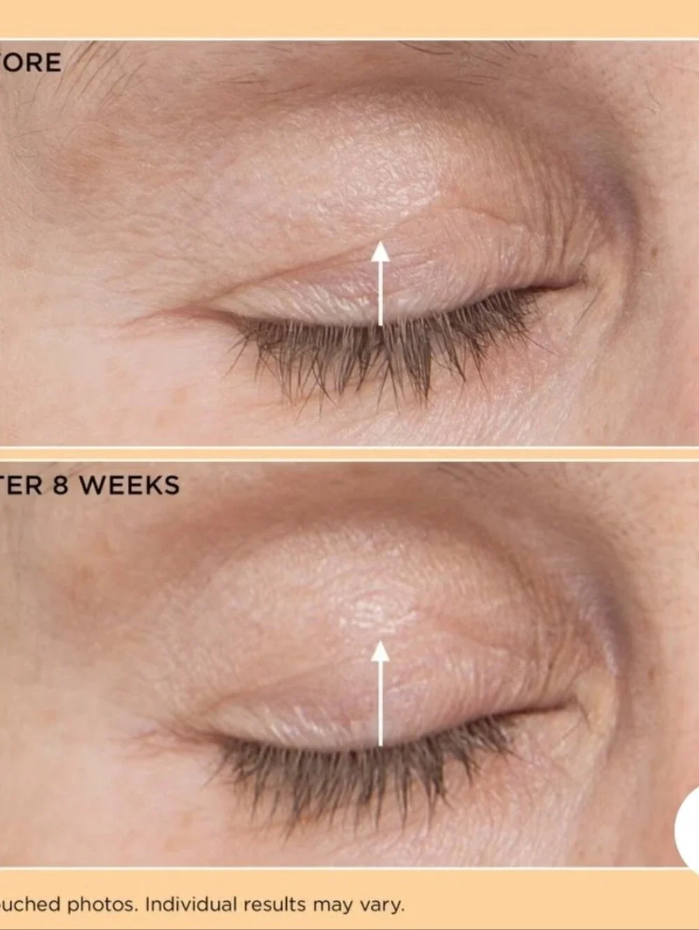 Perricone MD Eyelid Lift Serum - New In Box
